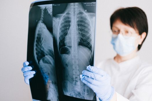 Seorang peneliti medis sedang menganalisis profil keanekaragaman mikrobioma usus dan pola genetik pasien menggunakan visualisasi data digital modern di laboratorium kedokteran presisi.
