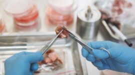 Pemeriksaan sampel mikrobioma usus kini menjadi standar baru dalam kedokteran presisi untuk merancang pola makan dan gaya hidup yang disesuaikan dengan kebutuhan biologis setiap individu.