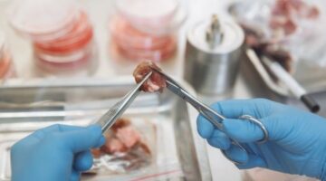 Pemeriksaan sampel mikrobioma usus kini menjadi standar baru dalam kedokteran presisi untuk merancang pola makan dan gaya hidup yang disesuaikan dengan kebutuhan biologis setiap individu.